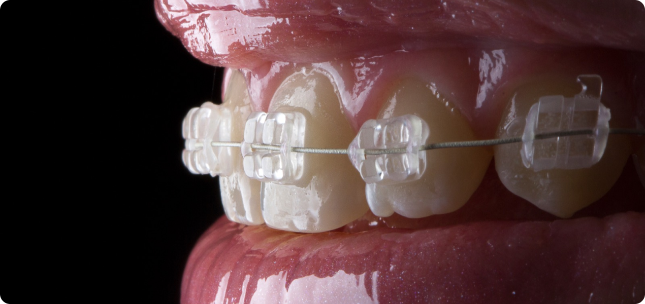 Assistance aux praticiens de l'orthodontie
