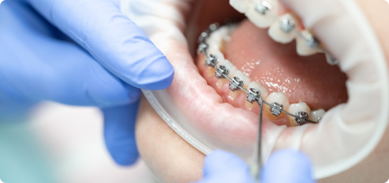 Plateforme numérique pour un suivi complet en orthodontie
