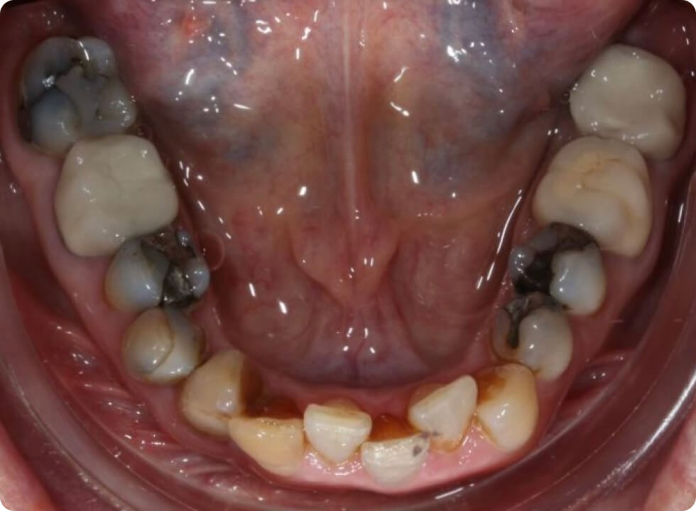 Aide professionnelle pour les praticiens de l'orthodontie