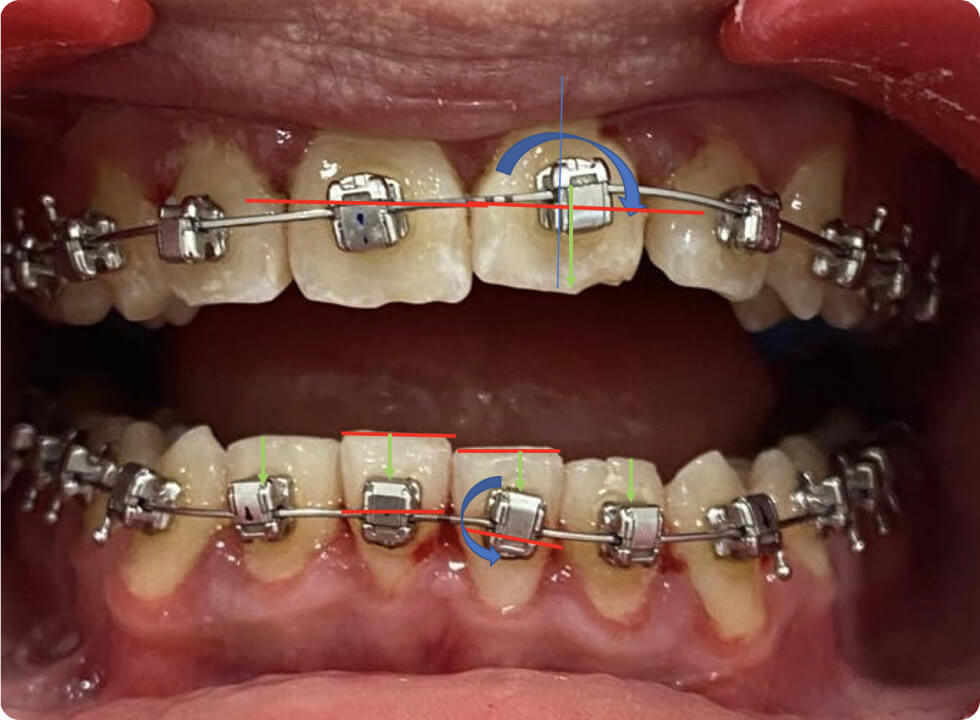 Assistance personnalisée aux praticiens en orthodontie