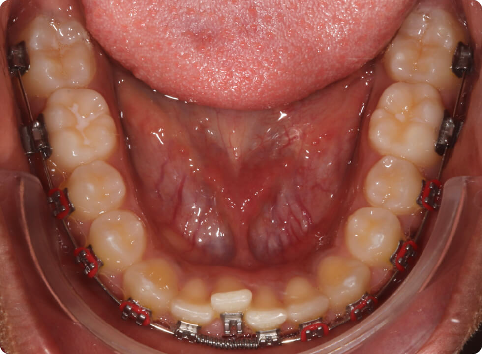 Aide spécialisée pour les praticiens en orthodontie