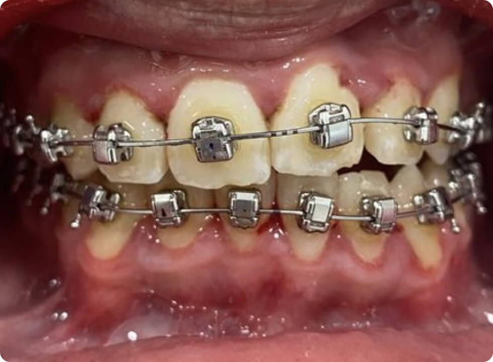 Exemples de cas cliniques concrets suivis via la plateforme numérique Orthosafe