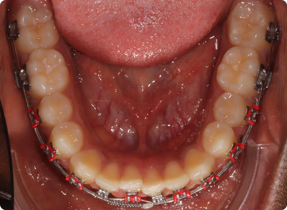 Résultats de cas cliniques de la plateforme Orthosafe