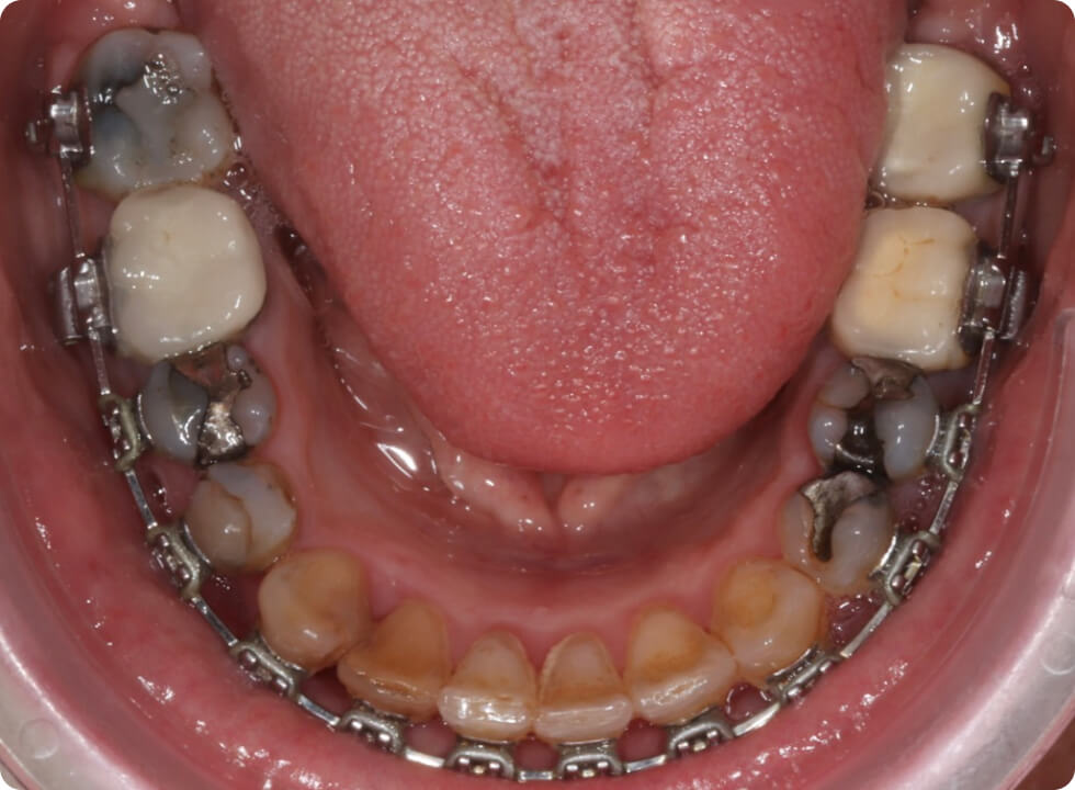 Cas cliniques avec le suivi numérique détaillé