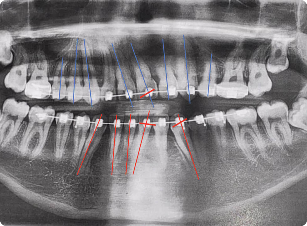 Conseil expertisé pour les praticiens de l'orthodontie