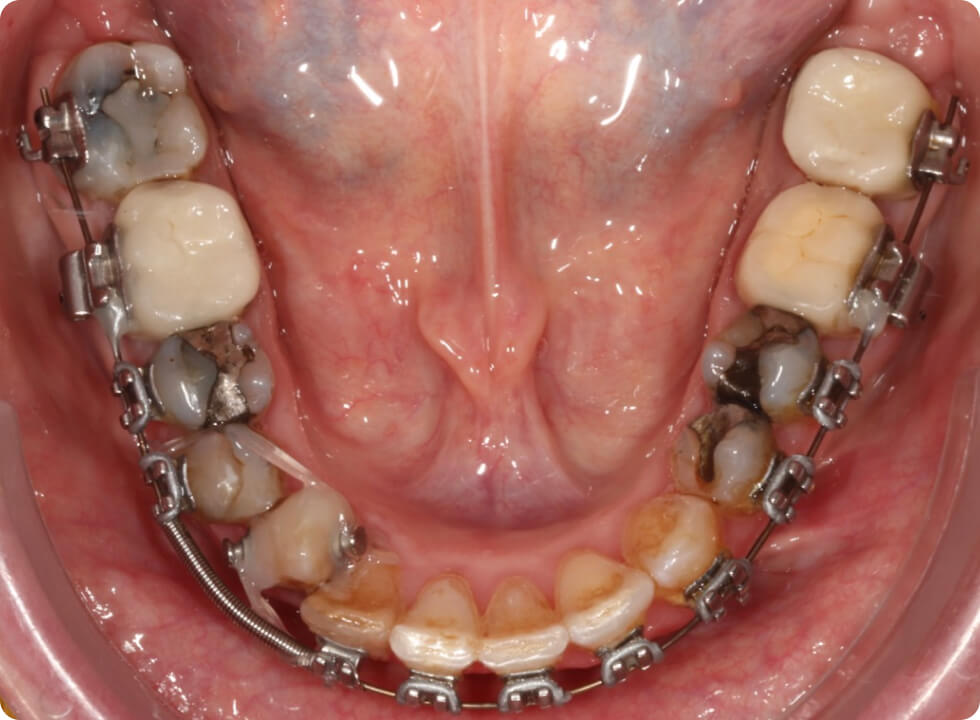 Cas cliniques ayant bénéficié du suivi de la plateforme numérique