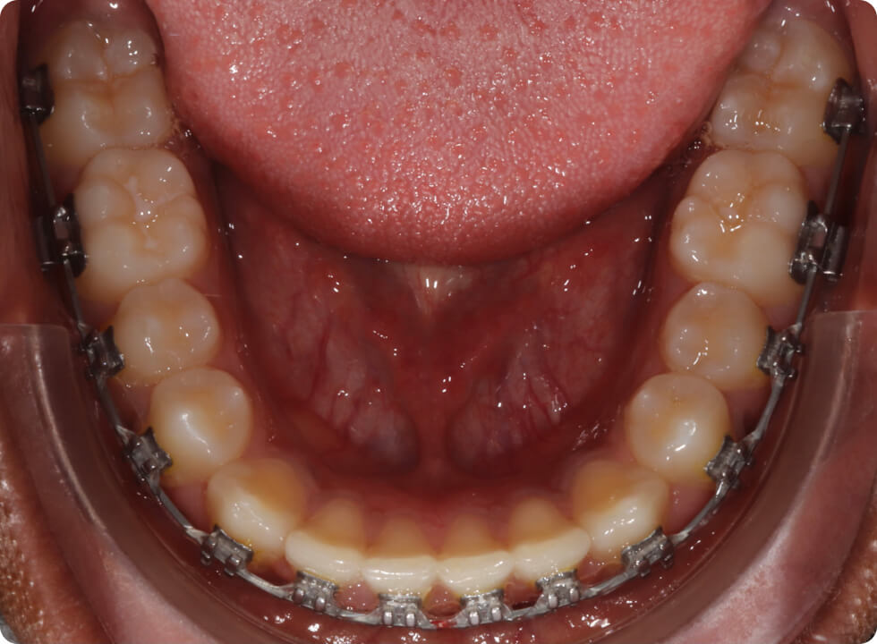 Assistance professionnelle pour les praticiens de l'orthodontie.