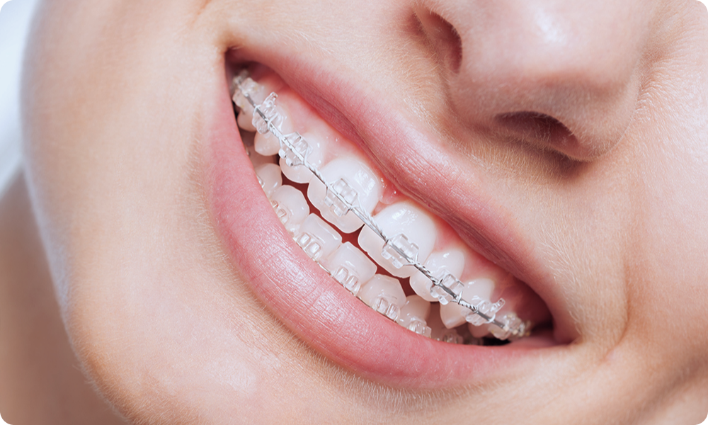Plateforme numérique pour l'assistance détaillée pour les praticiens en orthodontie
